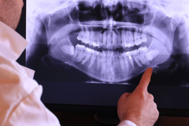 Best Emergency Dentist for Lost Fillings or Crowns in Melville, RI