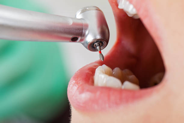 Best Holiday Emergency Dentist in Melville, RI